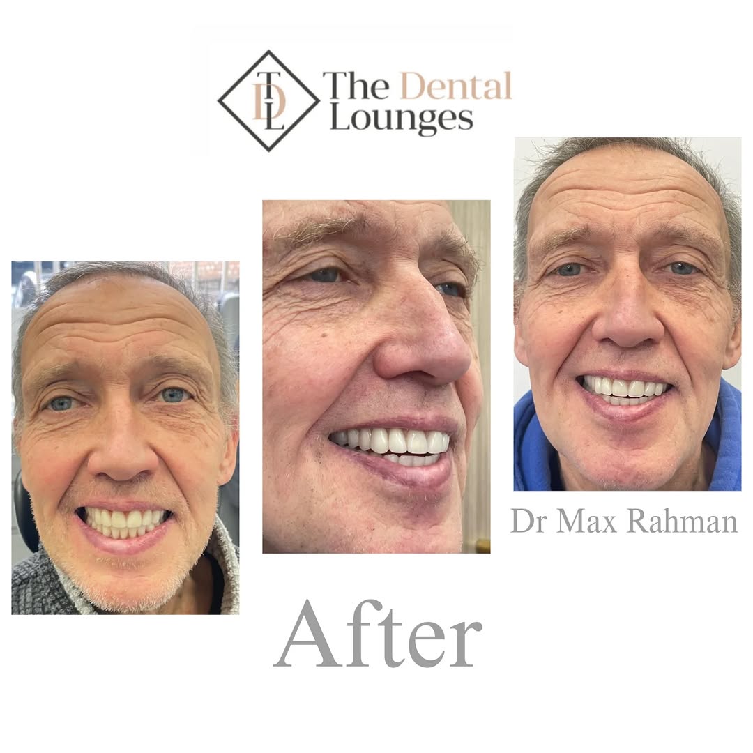 Happy patients at The Dental Lounges Wimbledon